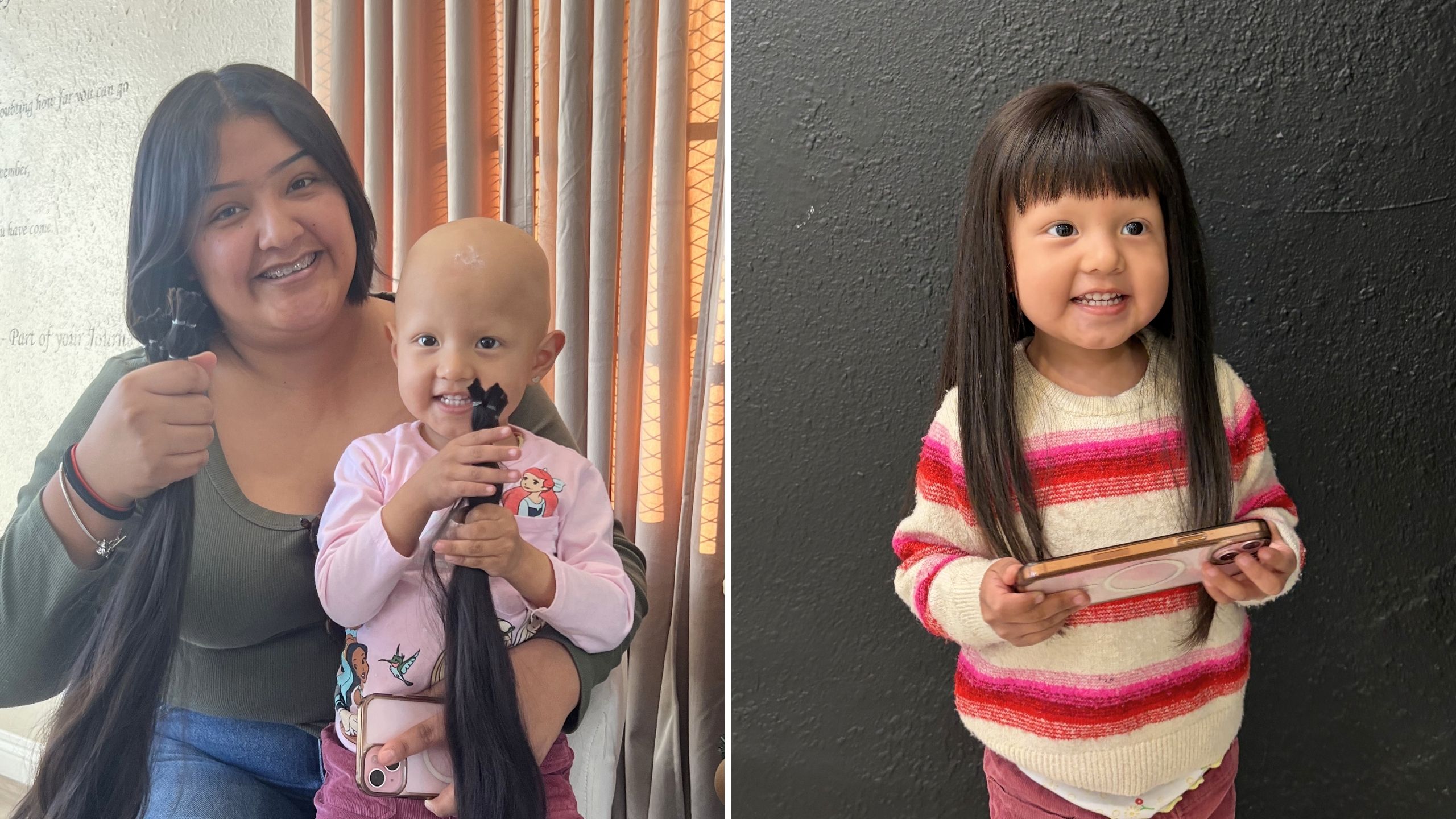 Mom Donates Hair To Make Wig For Daughter With Alopecia